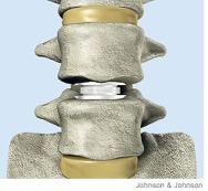 [Spine]